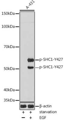 Western Blot: SHC1 [p Tyr427] AntibodyAzide and BSA Free [NBP3-16938]